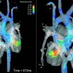 3D MRI image of the heart