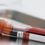 анализ крови на МНО