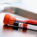 анализы на билирубин