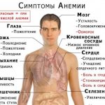-anemia-1-e1455947056635.jpg