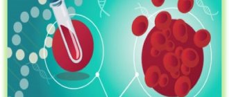 anemia