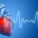 Arrhythmia: symptoms and main causes