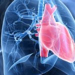 Arterial hypertension