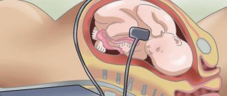 Беременность у пациенток с брадикардией