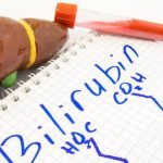 Билирубин. Что это такое, норма у женщин по возрасту, таблица. Диета, лечение при нарушении показателей