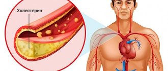 Blockage of arteries by cholesterol