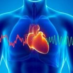 Pain due to heart problems