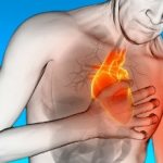 Chest pain due to heart attack