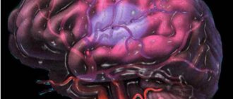 церебральная ишемия 2 степени у новорожденных последствия