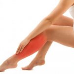 Чем лечить варикоз: топ-9 лучших мазей