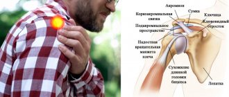 Что болит в плече