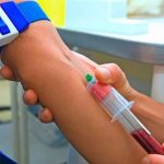 What is an APTT blood test? What should the indicators be? 