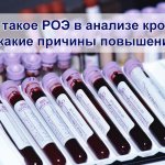 Что такое РОЭ в анализе крови