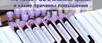Что такое РОЭ в анализе крови