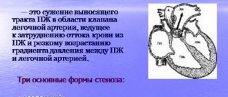 Что такое стеноз легочной артерии