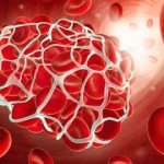 D-Dimer: normal during pregnancy