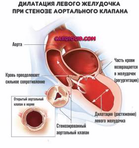 Дилатация изображения это