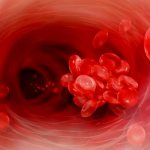 ДВС-синдром