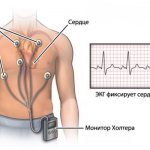 ecg how to do it correctly