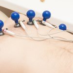 ECG in St. Petersburg