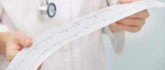Electrocardiogram