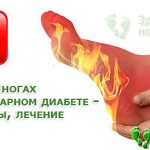 Если при сахарном диабете возникли сильные боли в ногах это повод для беспокойства
