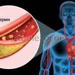 Where is cholesterol located?
