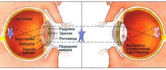Eye drops for diabetics - list of the best