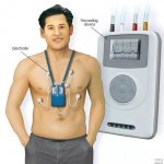 Holter ECG monitoring