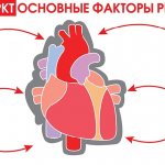 Heart attack Risk factors