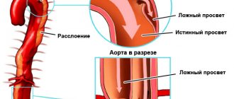 Уплотнение стенок вен латынь