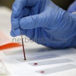 Blood test study