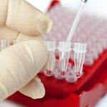 Исследование крови на глюкозу и холестерин