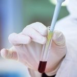 Changes in glucose in the body at the initial stage do not entail the appearance of any pronounced symptoms.