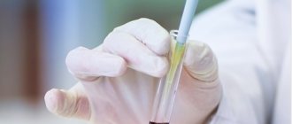 Изменение глюкозы в организме на первоначальном этапе не влечёт за собой появление каких-либо резко выраженных симптомов.