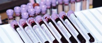 Image 1: Immunological blood test - Family Doctor clinic