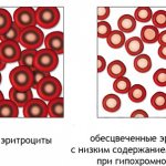 Qualitative and quantitative analysis
