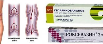 Как эти мази могут вылечить разрушенный клапан?