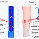 How do pelvic varicose veins form?