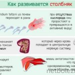 How does tetanus develop?