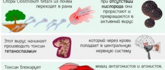 Как развивается столбняк