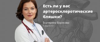 How do I know if I have atherosclerotic plaques? Cardiologist answers