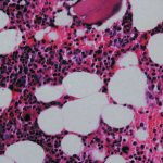 What do granulocytes look like?