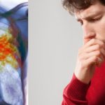 кашель с кровью