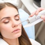 Coagulation of nasal vessels using laser method