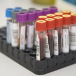 Transferrin saturation coefficient