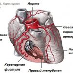 Coronary pulmonary fistula in a child or adult. What is it, causes, consequences, treatment 