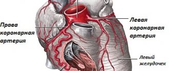 Coronary pulmonary fistula in a child or adult. What is it, causes, consequences, treatment