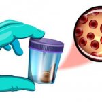 &#39;Blood in the stool: causes and characteristics of various diseases, diagnosis at the NeoMed AMDC