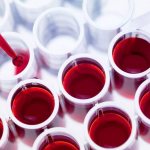 blood in the laboratory